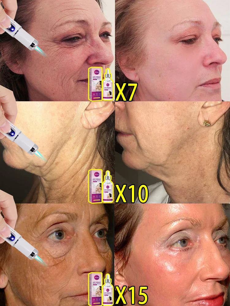 Look 10 Years Younger in Weeks: Say Goodbye to Wrinkles and Get Incredibly Firm, Radiant Skin